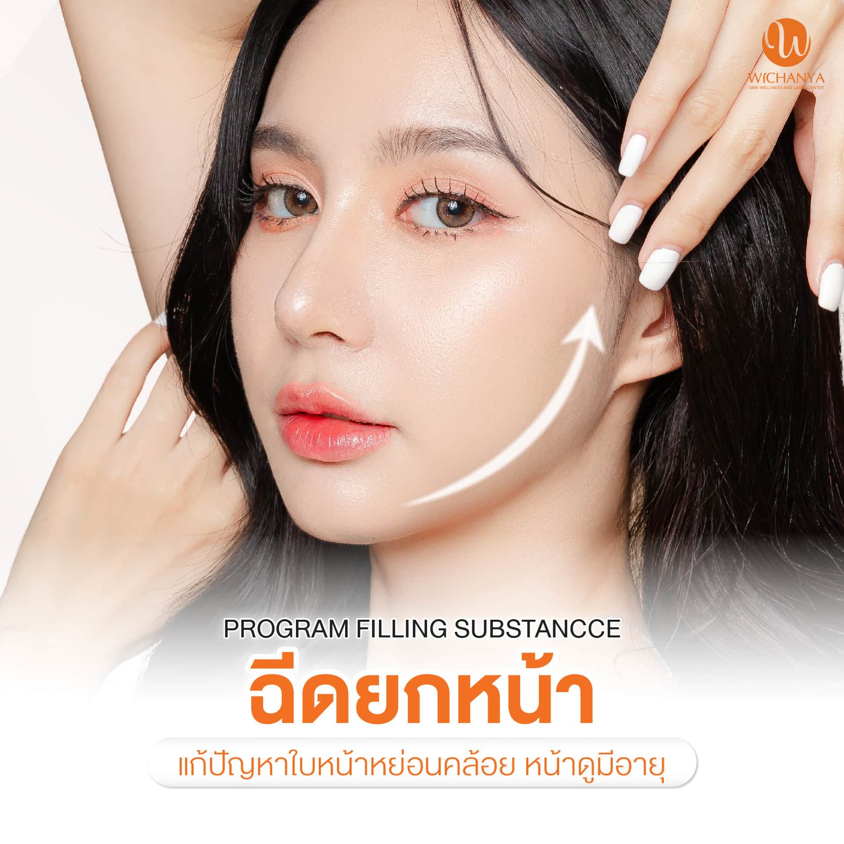ฉีดฟิลเลอร์ยกหน้า Filler