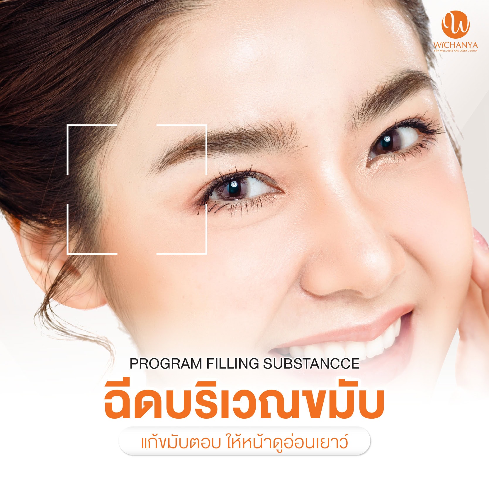 ฉีดฟิลเลอร์ขมับ เติมเต็มขมับ Filler