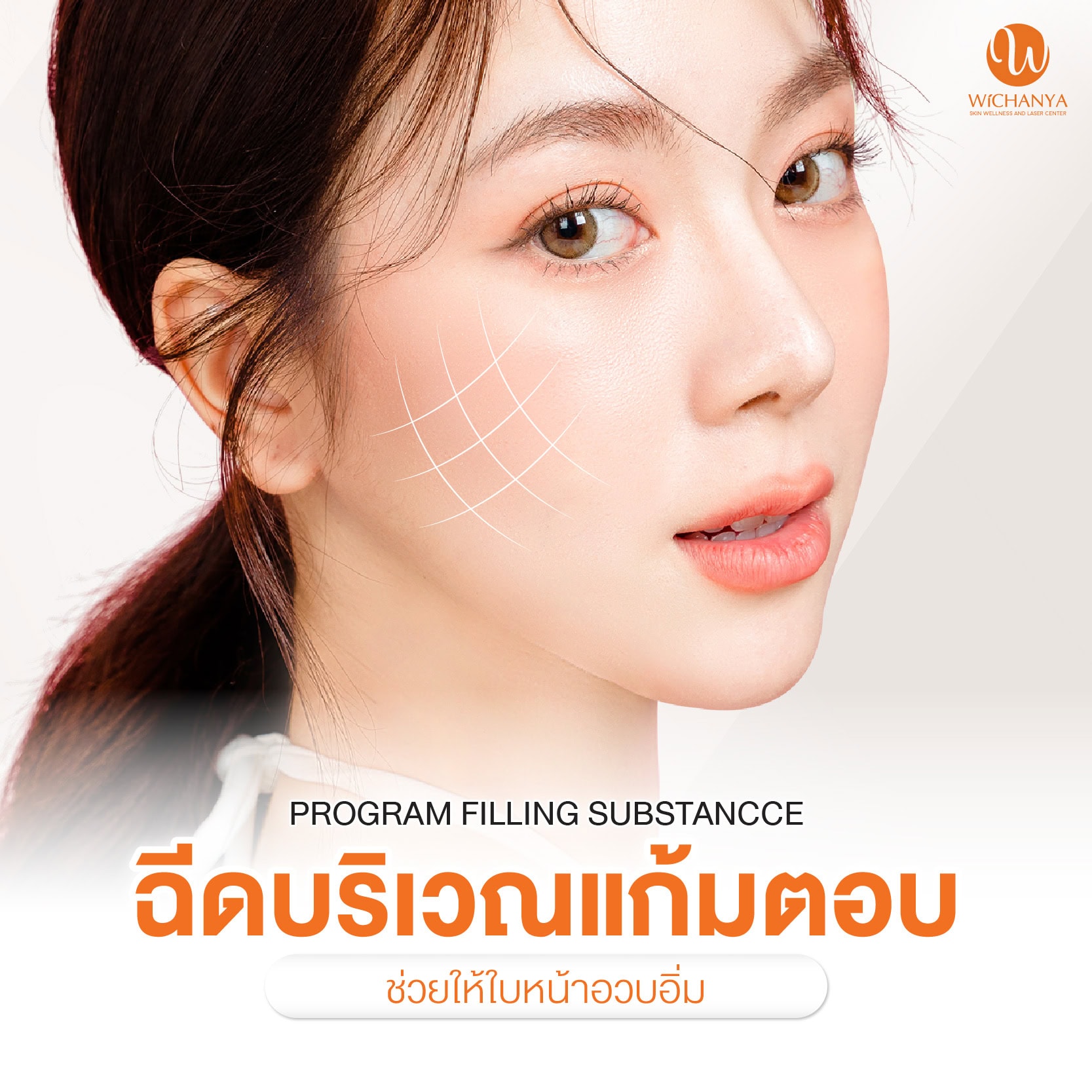 ฉีดฟิลเลอร์แก้มตอบ Filler
