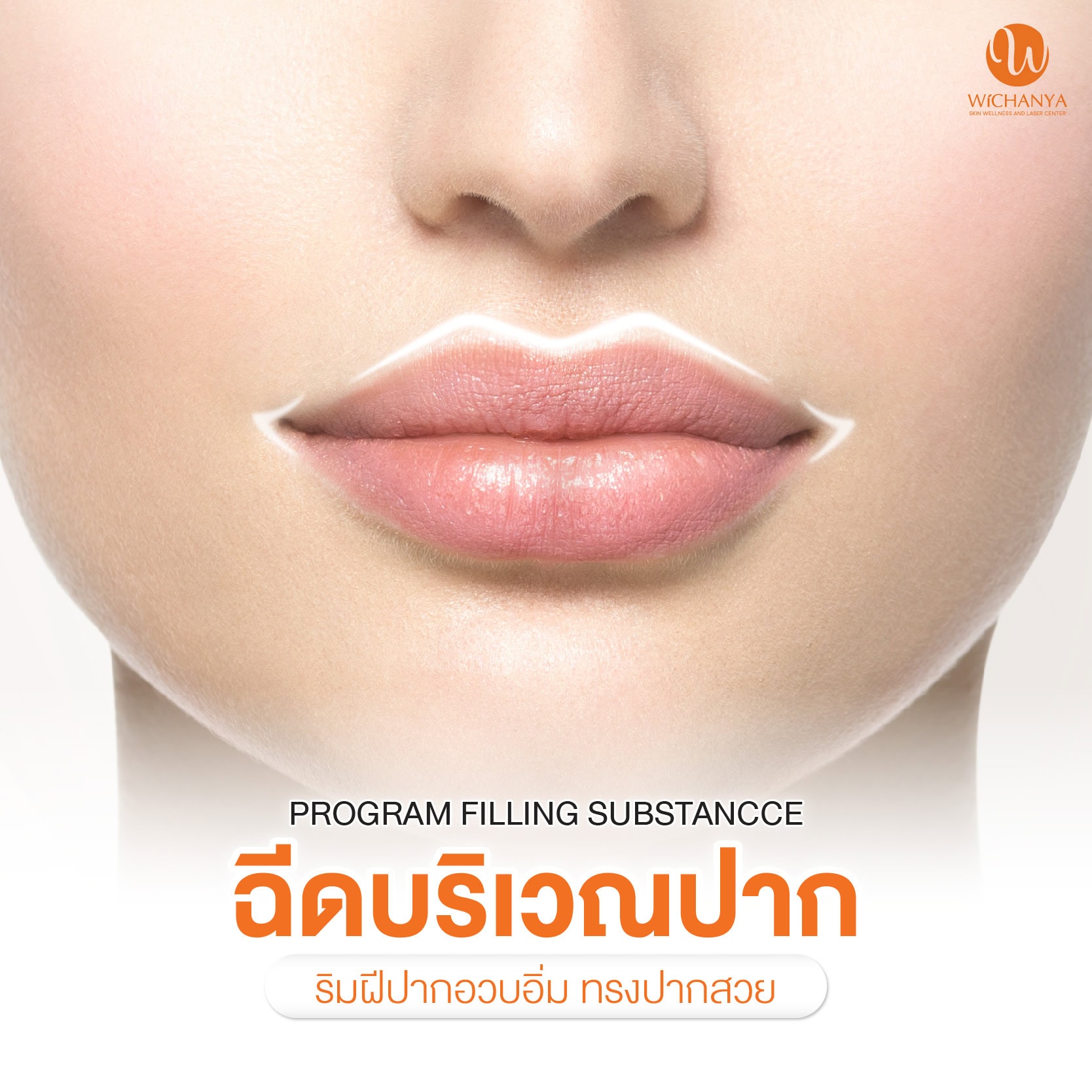 ฉีดฟิลเลอร์ปาก Filler